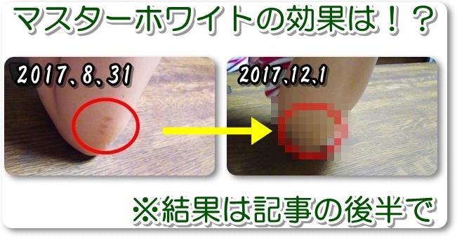 ・【おネエの本気すぎるレビュー】マスターホワイトの口コミ~美白ツイート中