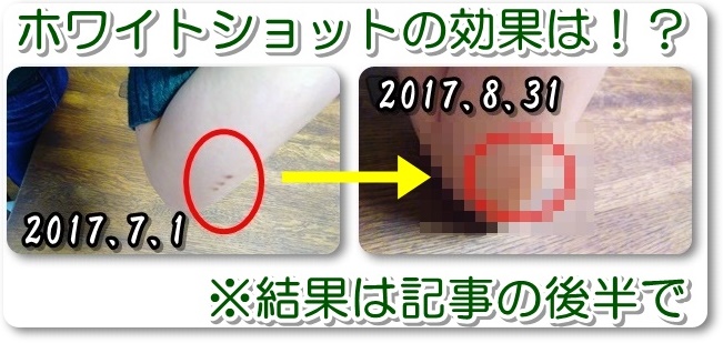 ・【おネエの本気レビュー】ホワイトショットインナーロックの口コミ