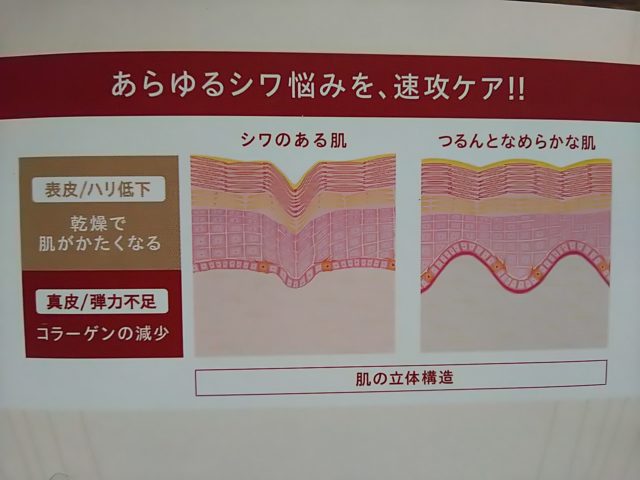 ザリンクレス　KOSE　シワ　たるみ　レポ　ブログ　効果